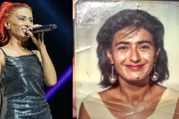 Yıllar sonra yaşadığı kazayı anlattı: ‘Sağ k...